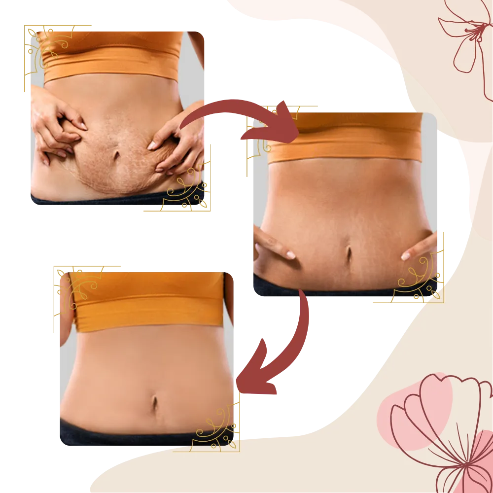 High Frequency Vibration Cellulite Massager