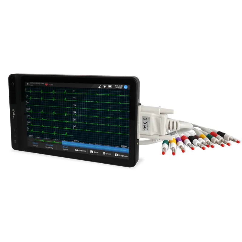 Smart Tablet Based 12-Lead ECG
