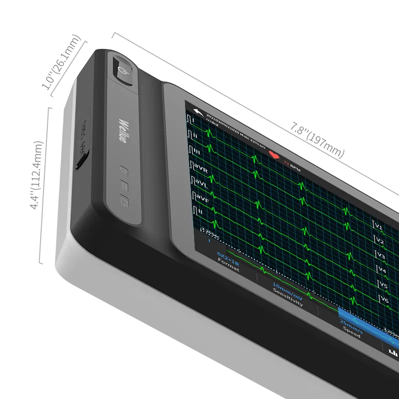 Smart Tablet Based 12-Lead ECG