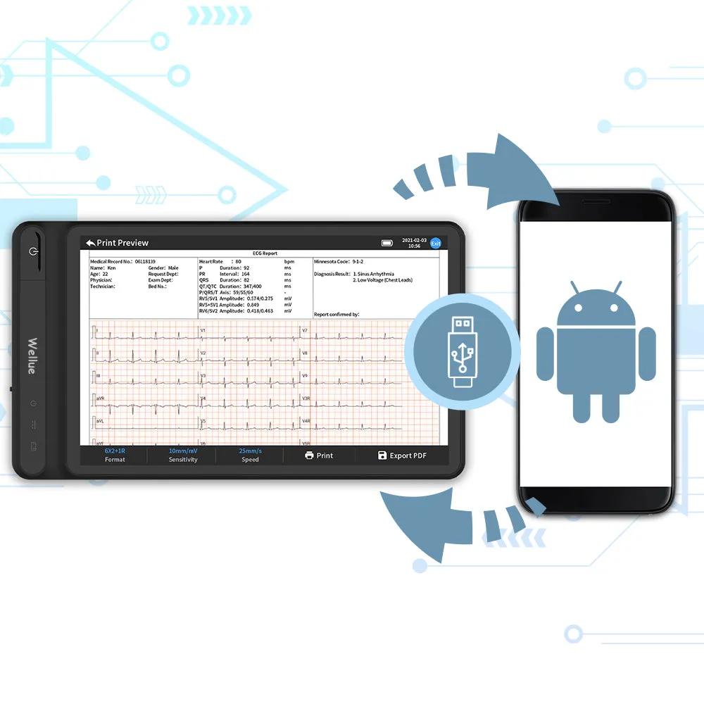 Smart Tablet Based 12-Lead ECG