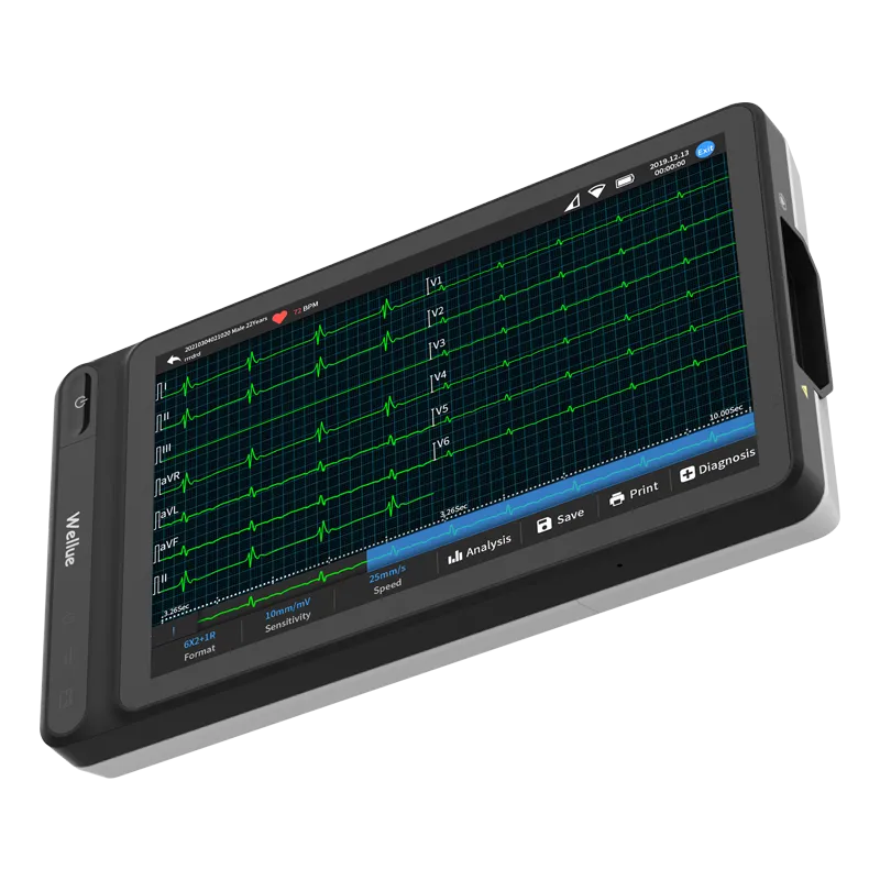 Smart Tablet Based 12-Lead ECG
