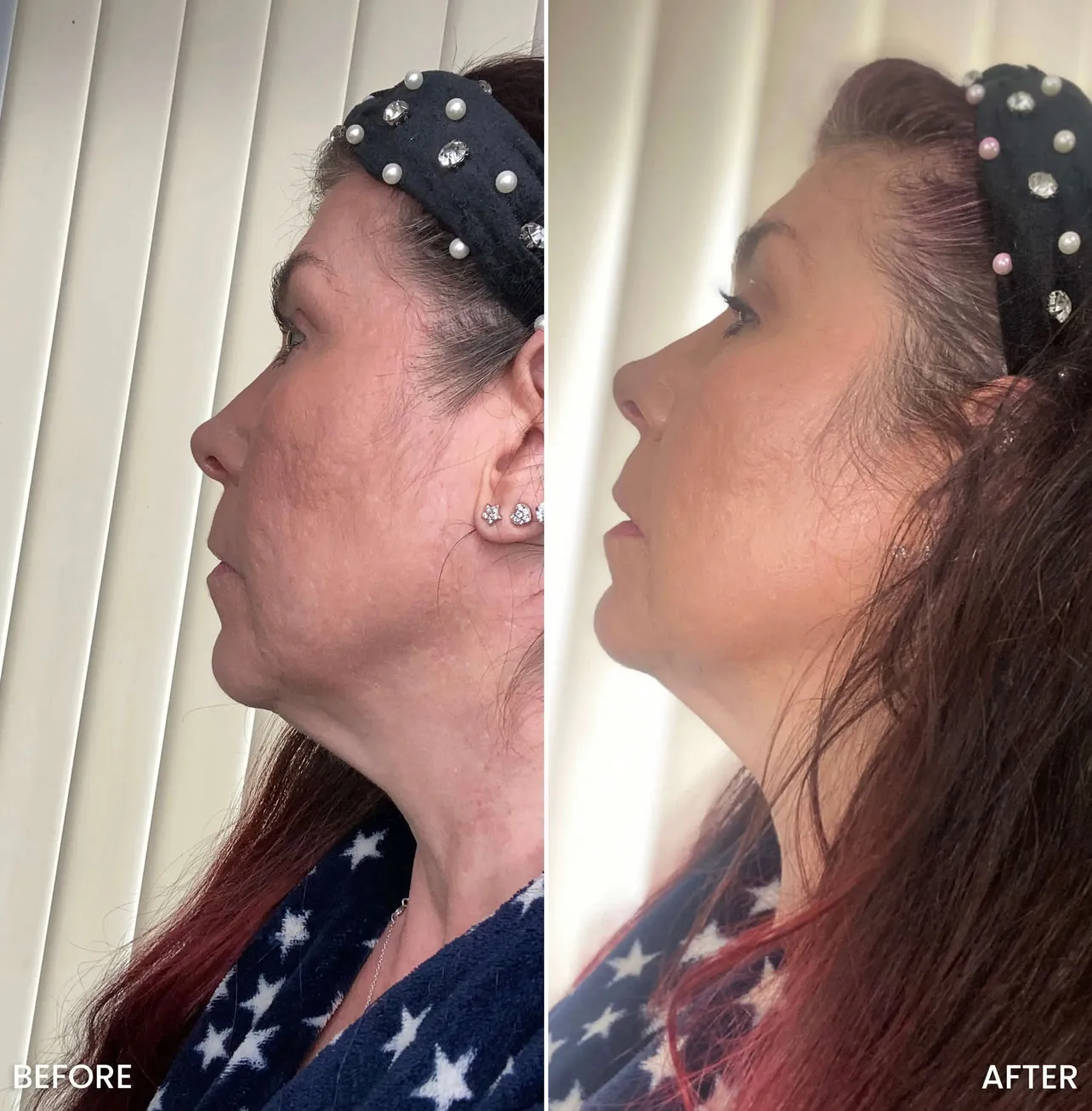 Tite FaceWare™️ BodyFirm Lifting & Toning Kit