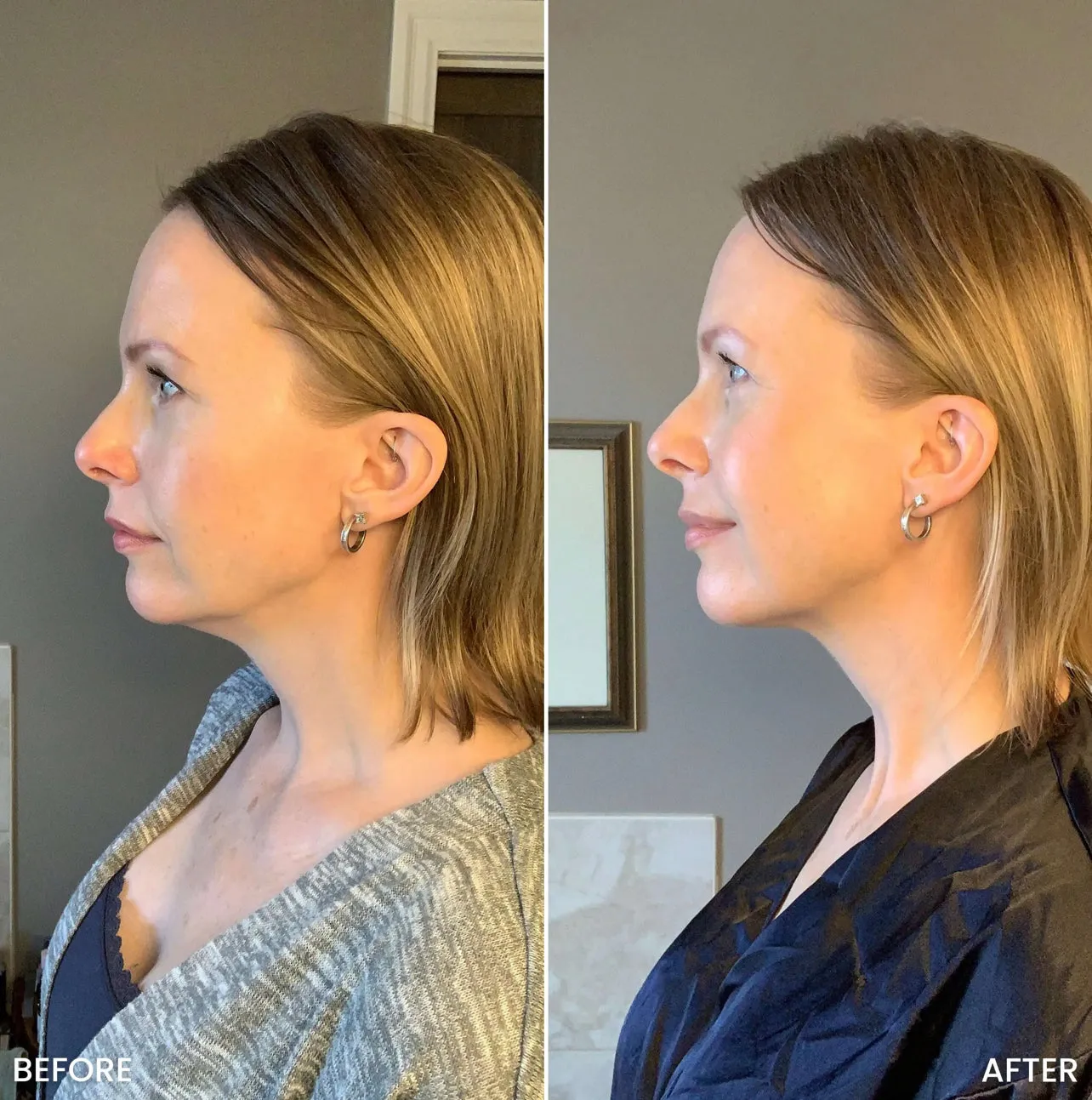 Tite FaceWare™️ BodyFirm Lifting & Toning Kit
